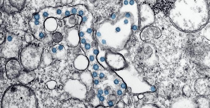 microscopic life